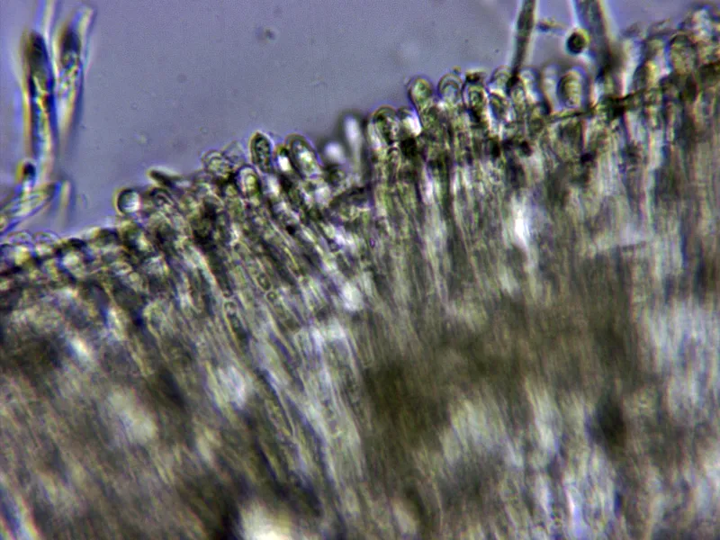 Cyathicula cyathoidea 15 - Pelos marginales Melzer